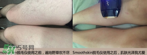 smoothskin和slikn infinity哪個好？smoothskin脫毛儀怎么樣