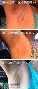 松下es wh93脫毛儀怎么樣？松下es wh93脫毛儀多少錢(qián)