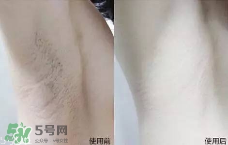 nair脫毛膏評(píng)測(cè)？nair脫毛膏保質(zhì)期