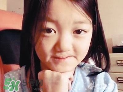 兔唇是什么？兔唇是什么原因造成的？