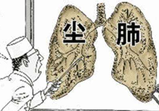 塵肺病能治愈嗎？塵肺病能活多久