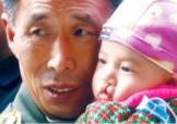 兔唇是什么？兔唇是什么原因造成的？