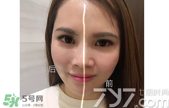 黃金棒有什么用？黃金棒的功效與作用
