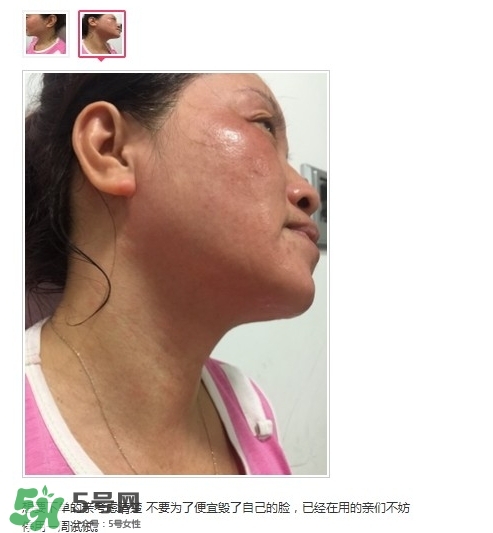 肌膚之食是什么牌子？肌膚之食讓我毀容了