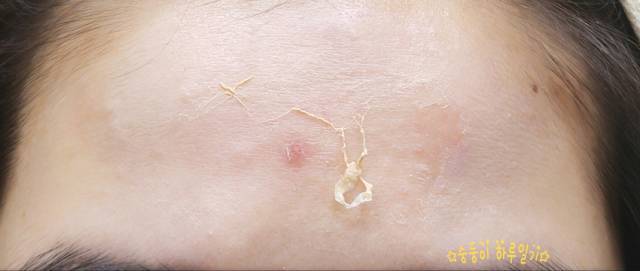 real skin patch怎么樣？real skin是什么牌子