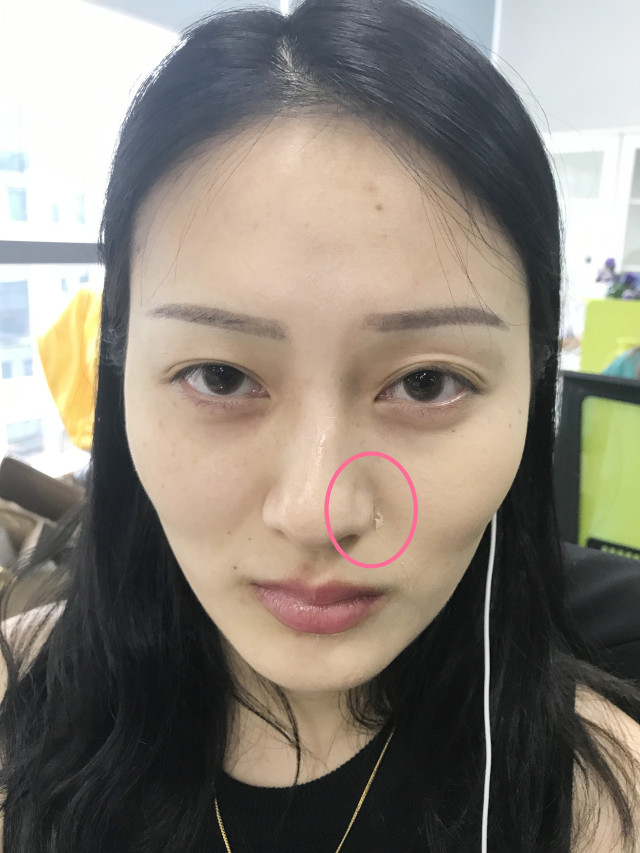 real skin patch怎么樣？real skin是什么牌子