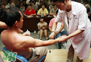刮痧痛嗎？刮痧疼還是拔罐疼