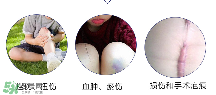 hirudoid除疤膏有效嗎？hirudoid去疤膏效果如何？