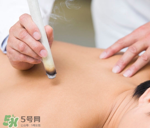 三伏貼和艾灸哪個好？三伏貼和艾灸區(qū)別