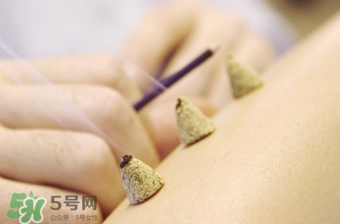 三伏貼和艾灸哪個好？三伏貼和艾灸區(qū)別