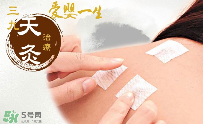 貼三伏貼掛什么科？三伏貼掛什么號(hào)？