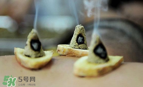 貼三伏貼可以艾灸嗎？貼三伏貼多久可以艾灸