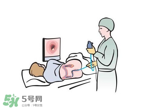 直腸癌怎么查出來的？直腸癌怎么判斷早晚期