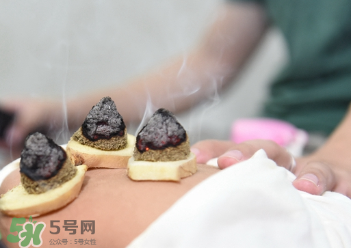 三伏灸什么人不能做？三伏灸適合哪些人？