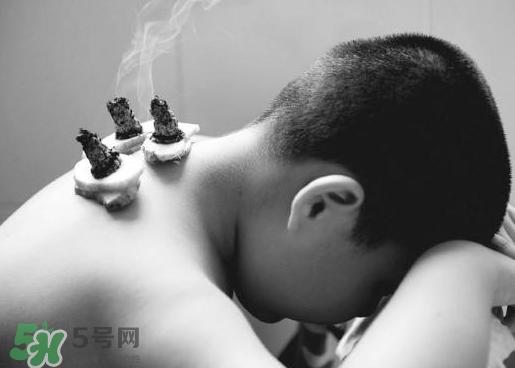 三伏灸什么人不能做？三伏灸適合哪些人？