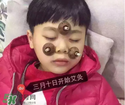 艾灸貼可以治咳嗽嗎？艾灸貼可以治退燒嗎？