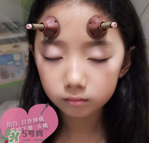 艾灸貼可以治咳嗽嗎？艾灸貼可以治退燒嗎？