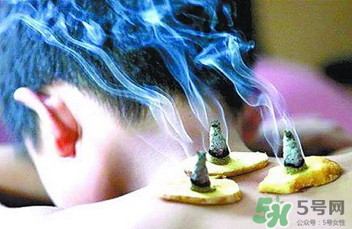 三伏灸什么時(shí)候開始灸？三伏灸怎么灸？