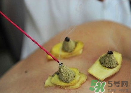 三伏灸可以自己灸嗎？三伏灸可以在家做嗎？