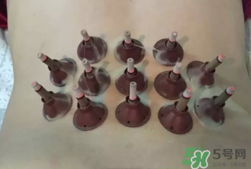 艾艾貼可以貼肚臍眼嗎？艾艾貼貼肚臍有什么作用？