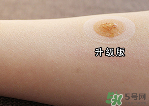 艾灸貼后有水泡怎么辦？貼艾灸貼應(yīng)注意些什么？