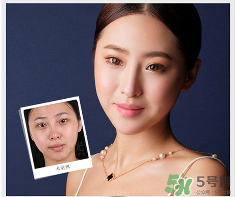 填充淚溝有風(fēng)險嗎？填充淚溝的方法