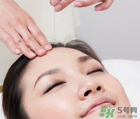 針灸可以自己扎嗎？針灸可以減肥嗎
