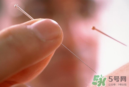 針灸可以治療失眠嗎？失眠時(shí)針灸哪些穴位有效