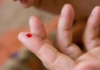放血療法能治濕氣重嗎？放血療法治病的原理是什么