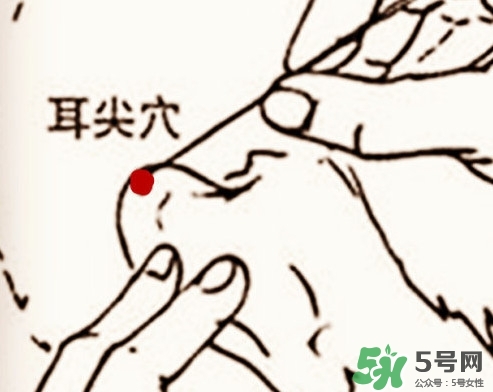 什么人不能做放血療法？放血療法有什么功效？