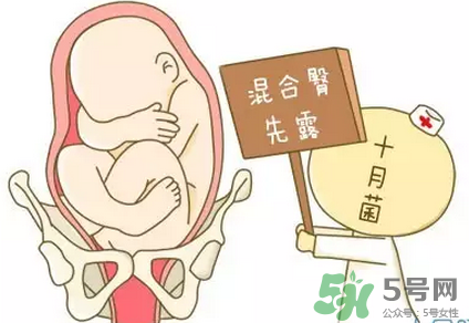 胎位不正能順產(chǎn)嗎？胎位不正怎么辦？