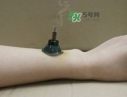 三伏天下雨可以艾灸嗎？三伏天下雨艾灸好嗎？