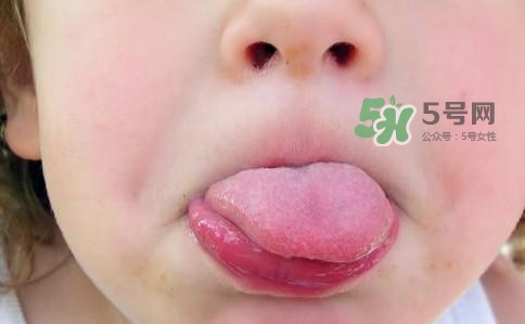三伏天為什么濕氣重？三伏天為什么要注意祛濕？