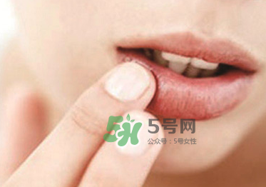 你的嘴唇為什么起泡 嘴唇上的水泡治不好嗎？