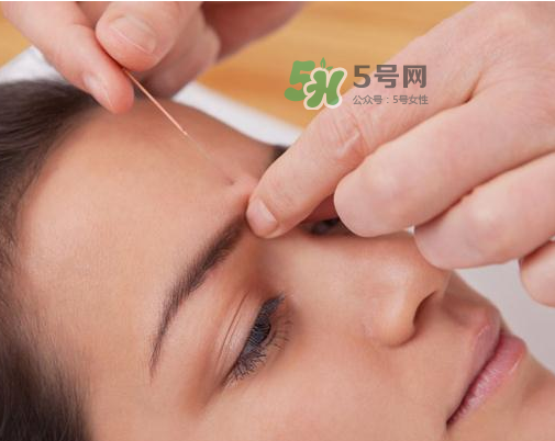 三伏天針灸有什么好處？三伏天針灸注意什么？