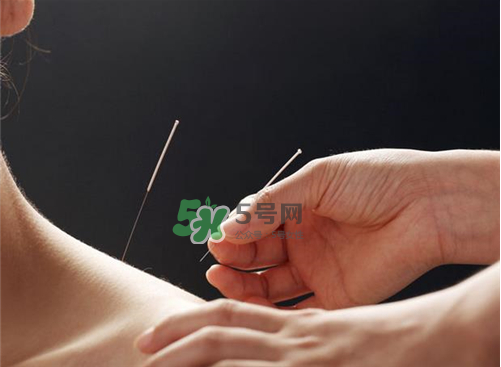 三伏天針灸有什么好處？三伏天針灸注意什么？