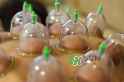 拔火罐是夏天好還是冬天好？什么時(shí)候拔火罐最合適？
