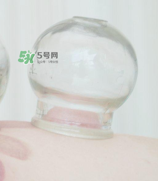 拔火罐一次多長(zhǎng)時(shí)間？拔火罐一般多長(zhǎng)時(shí)間？