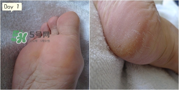 baby foot足膜怎么用？baby foot足膜使用方法