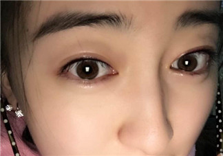 做美瞳線會(huì)不會(huì)掉睫毛？做美瞳線掉睫毛怎么辦？