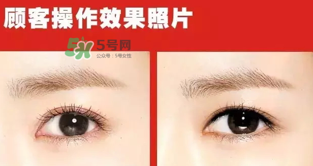 美瞳線有必要做嗎？做美瞳線多少錢？