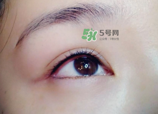 做美瞳線疼嗎？做美瞳線后要注意什么？