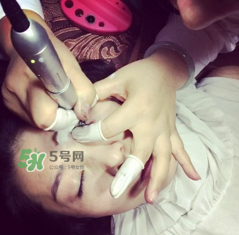 做美瞳線要打麻藥嗎？做美瞳線麻藥怎么敷？