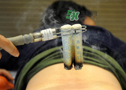 三伏天艾灸后能吹空調(diào)嗎？三伏天艾灸后能吹電扇嗎？