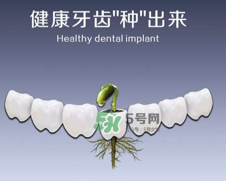 種植牙費(fèi)用多少錢(qián)？國(guó)產(chǎn)種植牙價(jià)格