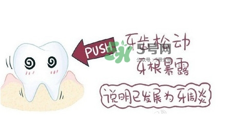 牙齒松動(dòng)會(huì)自己好嗎？牙齒松動(dòng)會(huì)自己掉嗎