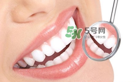 牙齒縫隙大怎么辦？牙縫大帶牙套有用嗎