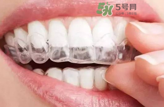 牙齒有縫隙可以補(bǔ)嗎？牙齒縫隙大能補(bǔ)嗎