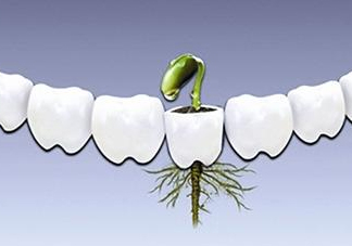 種植牙多少錢一顆？為什么種植牙很貴