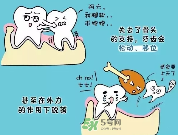 牙齒松動(dòng)會(huì)自己好嗎？牙齒松動(dòng)會(huì)自己掉嗎